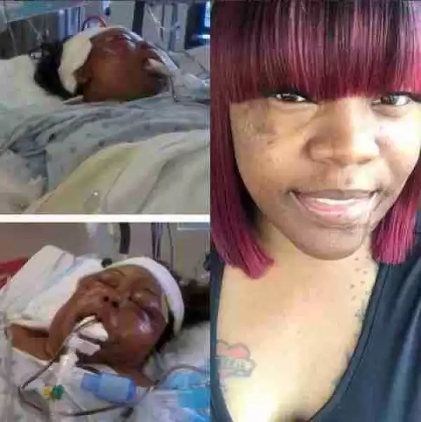 Lady Who Was Left In A Coma With Broken Ribs After Accident Tells Her Story (Pics)